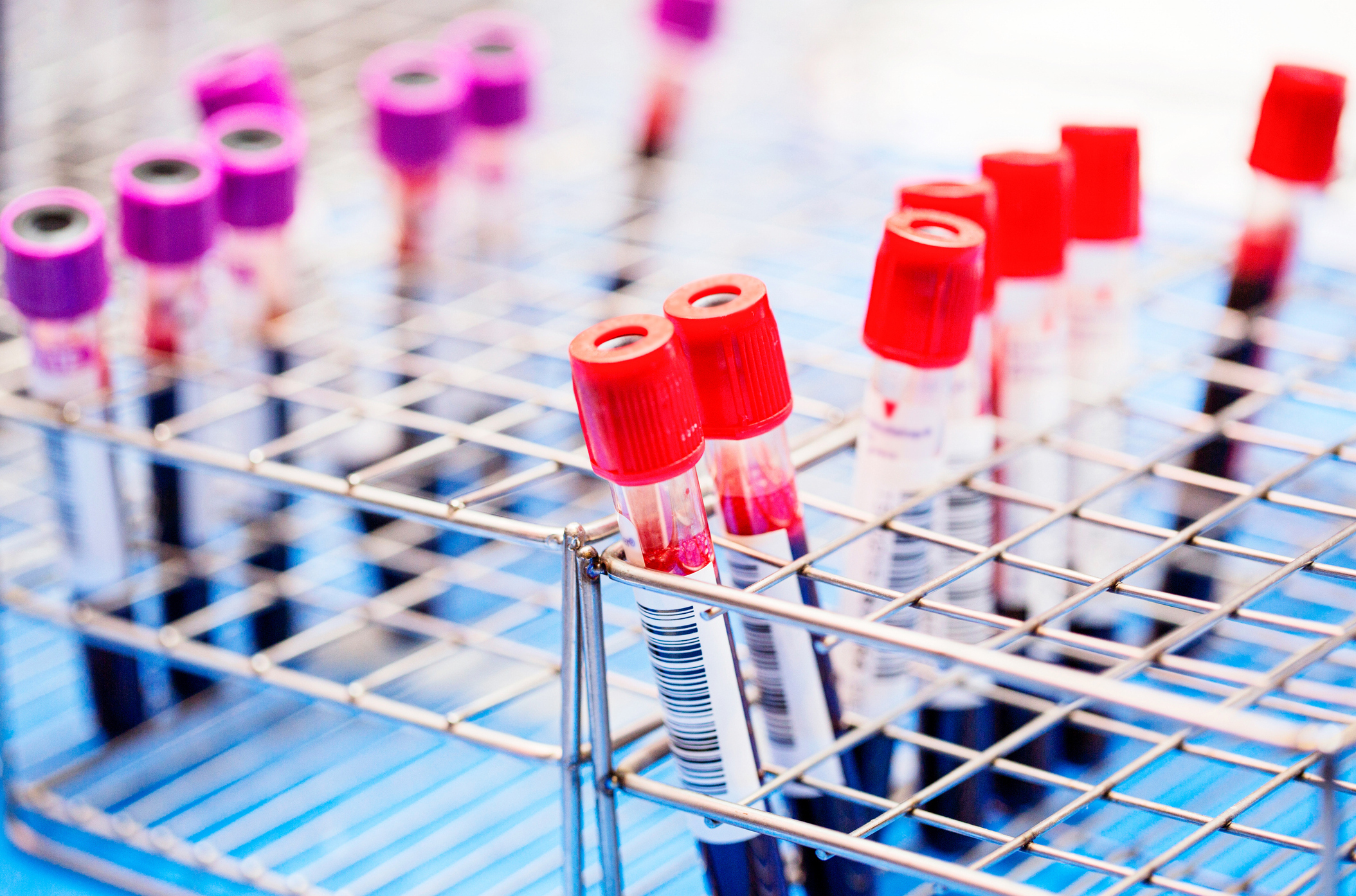 A simple blood test can detect colorectal cancer early, study finds