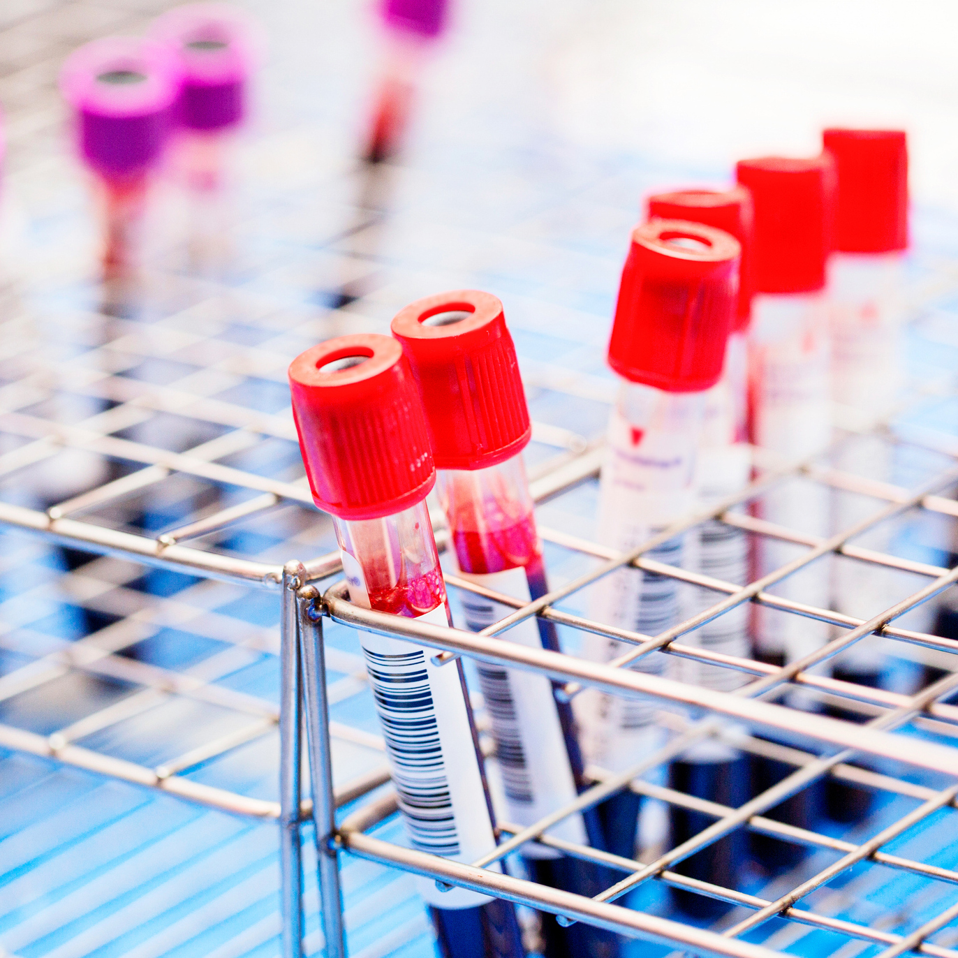 A simple blood test can detect colorectal cancer early, study finds