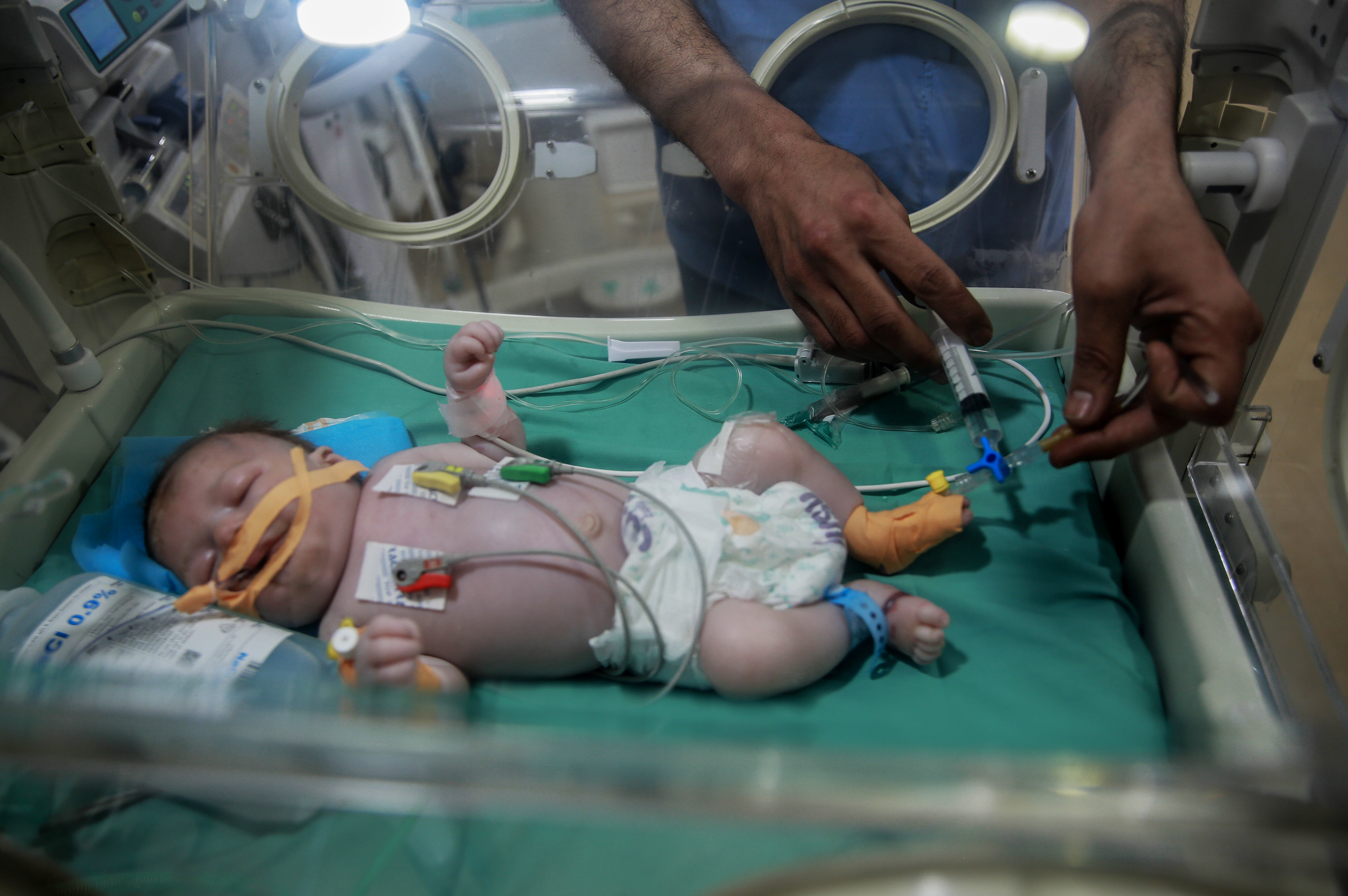 Struggle, struggle, struggle. What new and expecting mothers are facing in Gaza