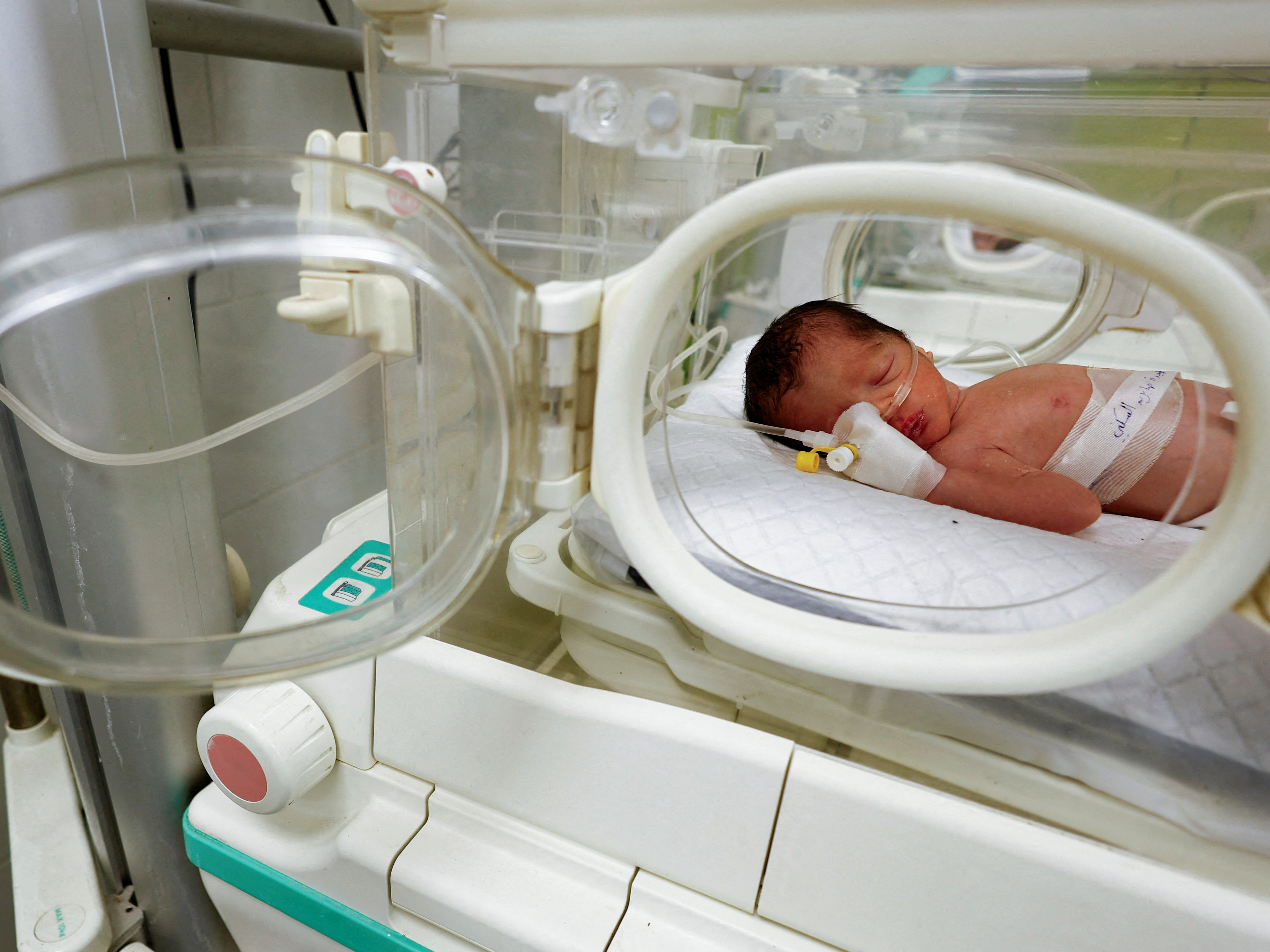 A baby girl born orphaned and premature after an Israeli airstrike in Gaza has died - Vimarsana News