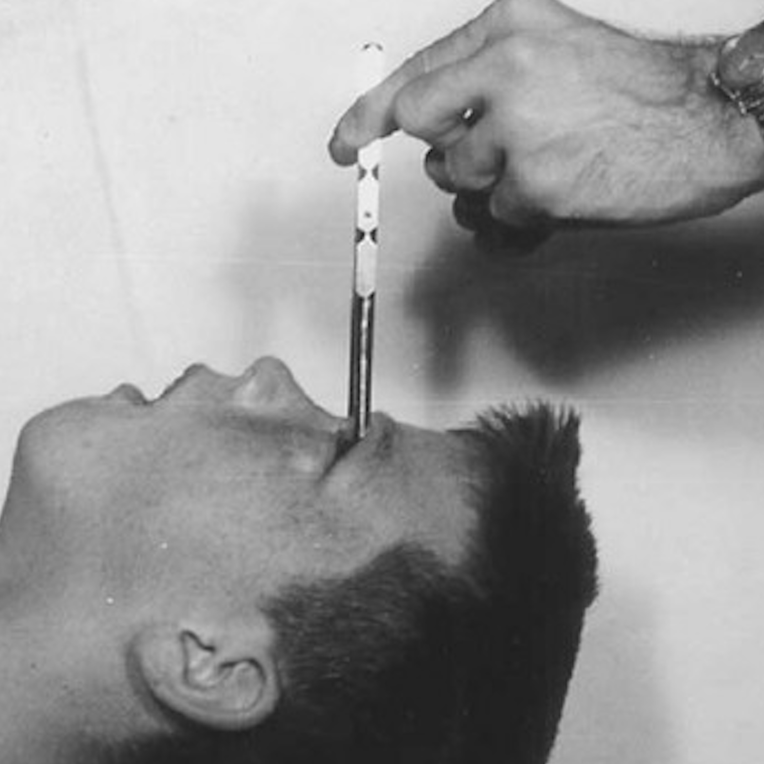 SPECIAL: Remembering Howard Dully of "My Lobotomy"