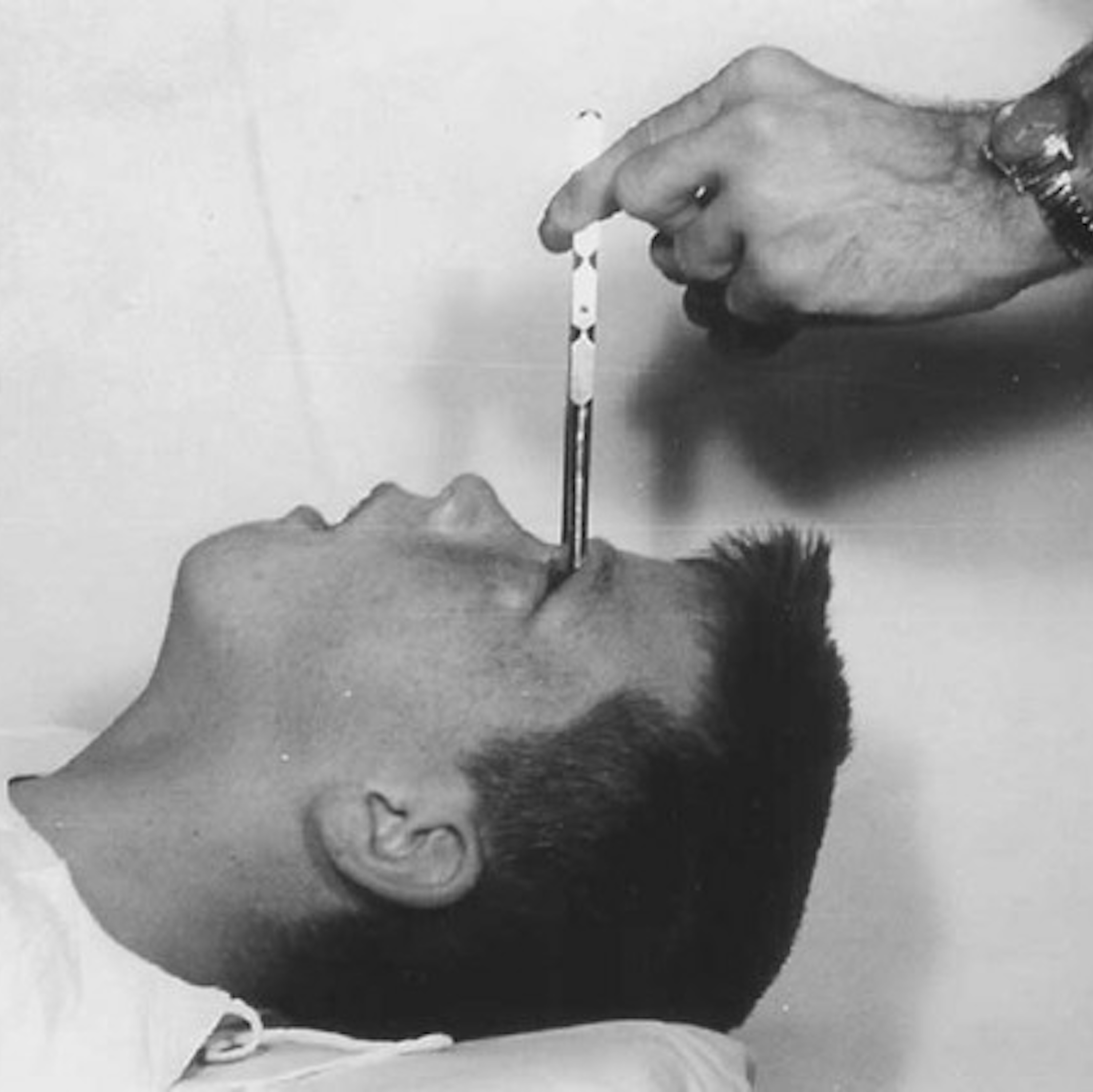 SPECIAL: Remembering Howard Dully of "My Lobotomy" - podcast episode cover