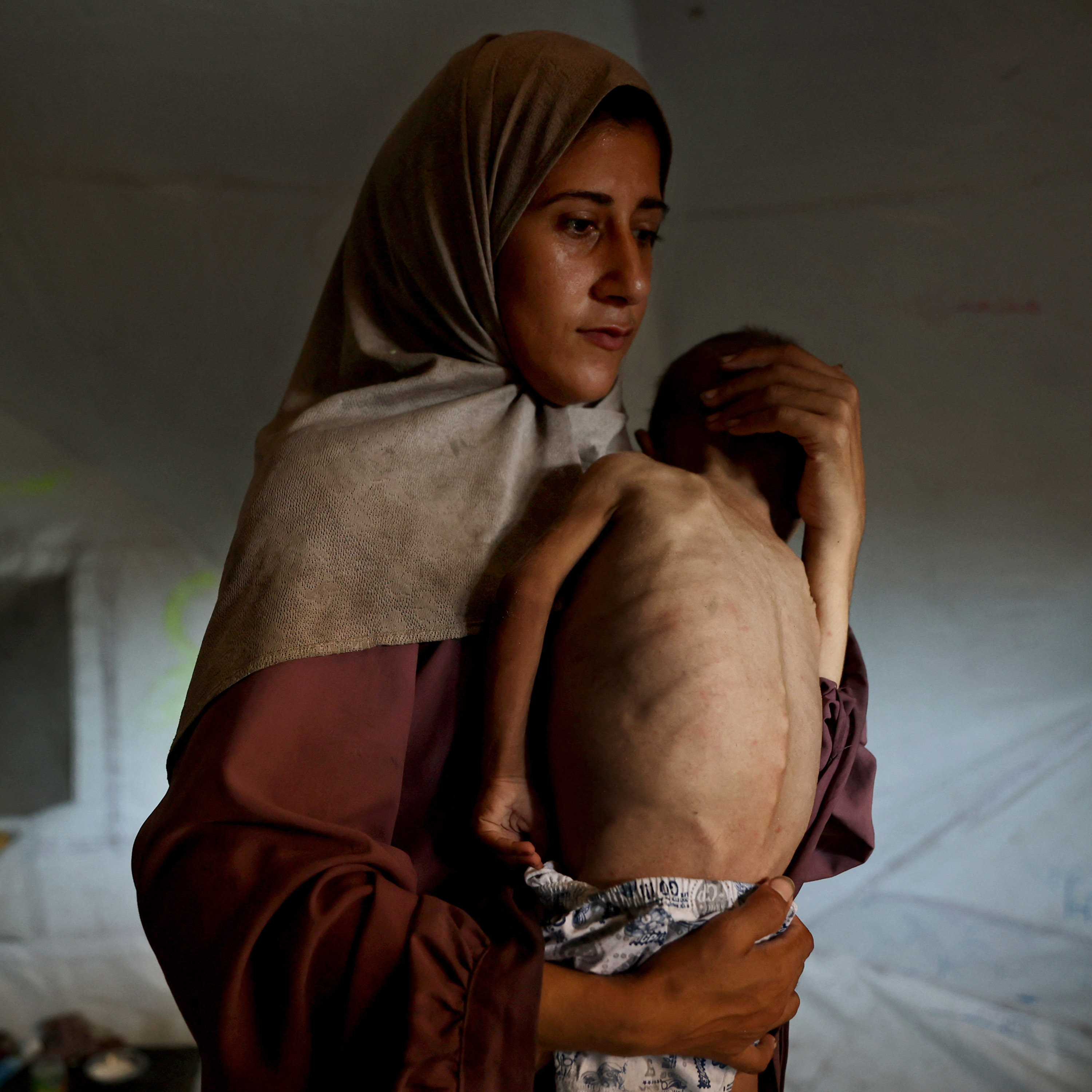 Extreme Hunger In Gaza. France To Recognize Palestinian State