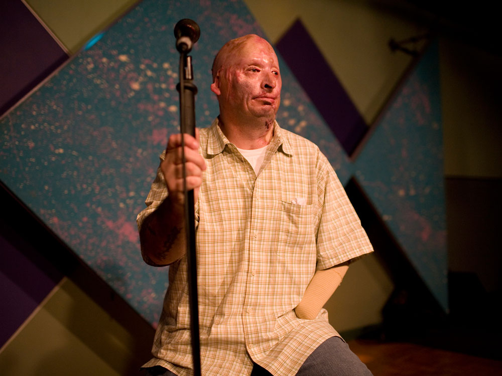 Staff Sgt. Bobby Henline was injured in Iraq by a roadside bomb three years ago, and was burned over nearly half of his body. After years of grueling physical therapy, he now performs at open mic night at the Rivercity Comedy Club in San Antonio.