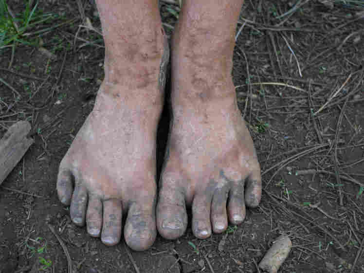 Dirty feet. iStockphoto.com