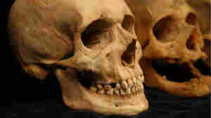 As Our Skin Sags With Age, So Do Our Bones
