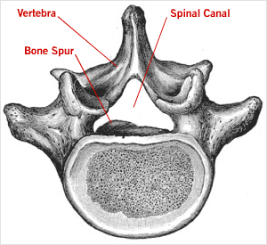 spine 300 53c0bcc15f1a0deea3b7575ab7c042dd41b5dab2