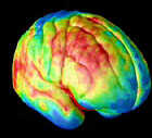 Film Shows Pattern of Brain Maturation : NPR