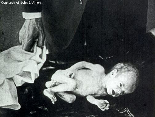 A closeup picture of a very unhappy looking baby.