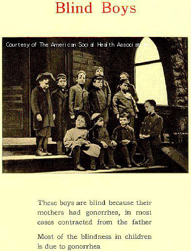 Blind Boys - Group of young, blind boys standing and sitting on steps.