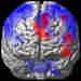 Neuroscientist Uses Brain Scan to See Lies Form