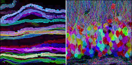 Motor neurons and dentate gyrus, dual image.