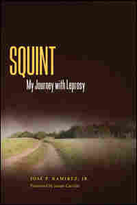 'Squint' book cover